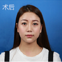 美莱案例代儿对比图后