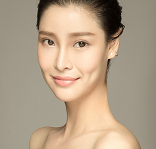 成都美莱<a href='/' target='_blank'><u>整形医院</u></a>杨雅芙案例