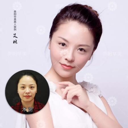 吴豫芳医师带你探究面部整形美容之中的奥秘