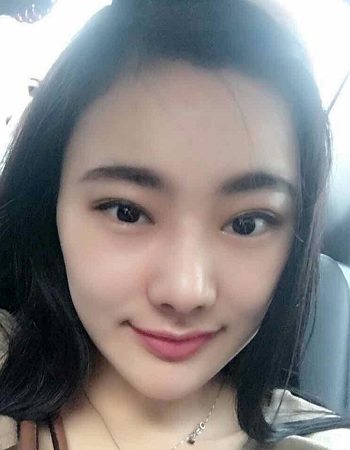 美莱案例刘雨婷对比图后