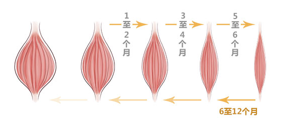 广州美莱瘦脸能维持多久