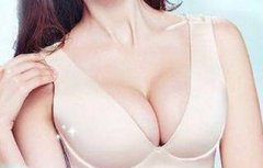 假体隆胸会影响哺乳吗会变形吗