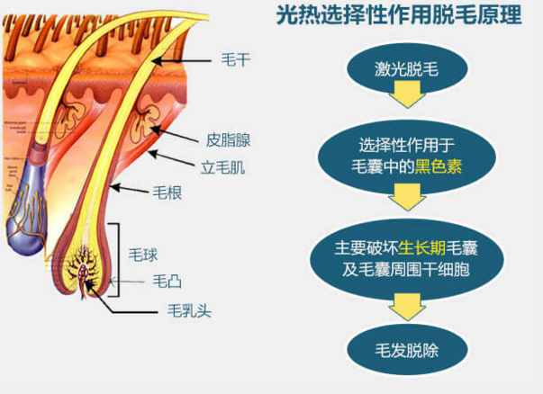 深圳激光脱毛对皮肤危害性大吗