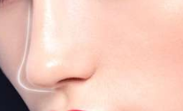 天津美莱膨体隆鼻的效果可以维持多久