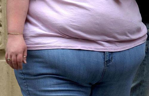 身体肥胖做吸脂手术安不安全