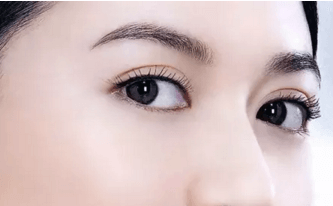 在武汉美莱做全切双眼皮手术大致过程