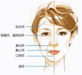 激光除皱的效果可以维持多久