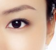 北京做韩式祛眼袋术后效果能维持多久呢