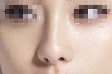 鼻子整形恢复期间要怎么护理