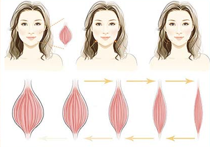 瘦脸注射后多久见效