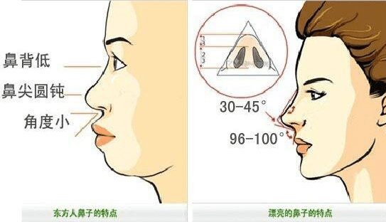 成都做玻尿酸隆鼻手术有哪些优势