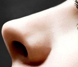 沈阳做假体隆鼻术后鼻子会变形吗