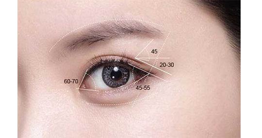 深圳全切双眼皮手术恢复时间是多久