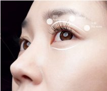 重庆常用的双眼皮整形方法有哪些？