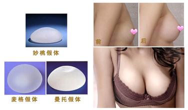 佛山假体隆胸后可以母乳吗？