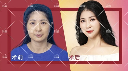 2019年的flag：悦美女人更悦美莱