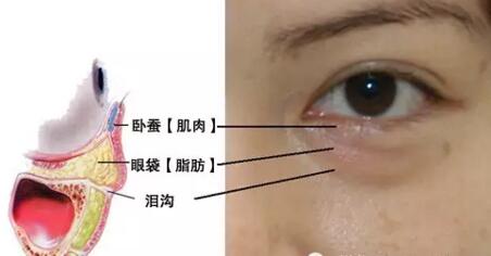 北京切除眼袋术会出现疤痕吗