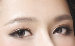 广州割双眼皮选择哪里比较好些呢