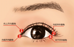 厦门开眼角术后完全恢复需多久