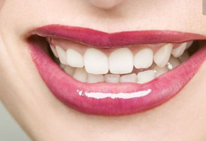 牙齿矫正能用多久？