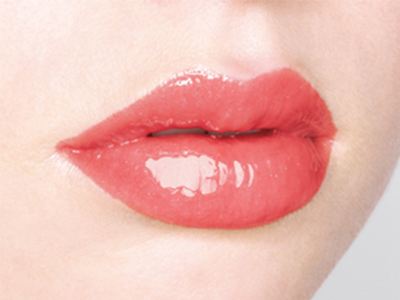 玻尿酸丰唇的效果怎么样？