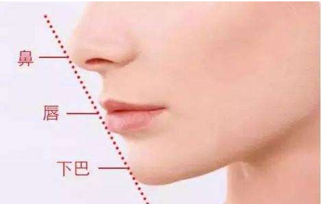 杭州膨体隆鼻术后恢复期需要多久