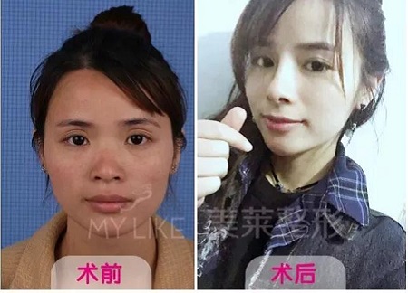 长着一张“大妈脸”的她，却比乔妹还能收割男神？！