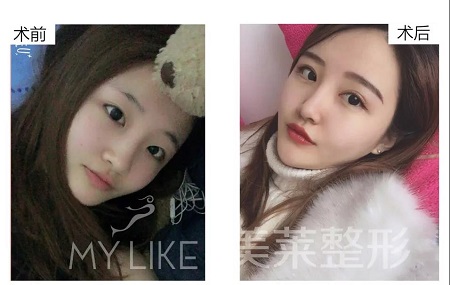 美莱特邀整形医师—卜胜利主任，3月4日亲诊石家庄美莱。