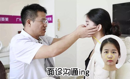 换对鼻子宛如换了一张脸