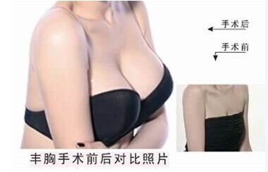 有什么办法让乳房变美呢？