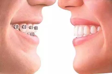 口腔整形的一般有哪些特点