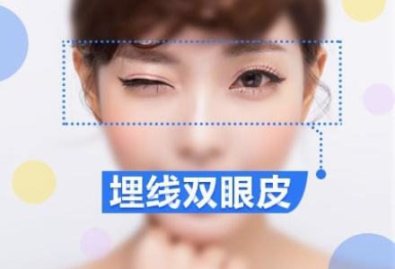 埋线双眼皮价格多少？