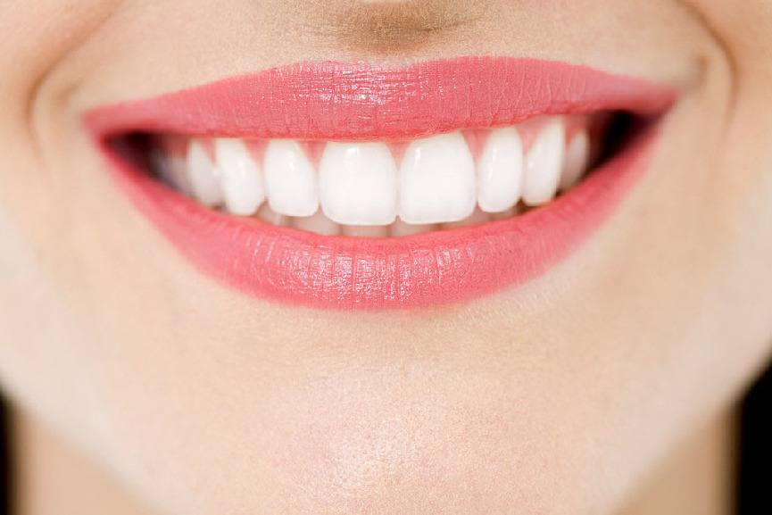 冷光牙齿美白的时间能够维持多久？