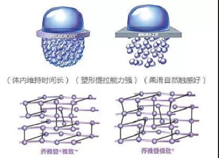 玻尿酸为什么维持时间短？