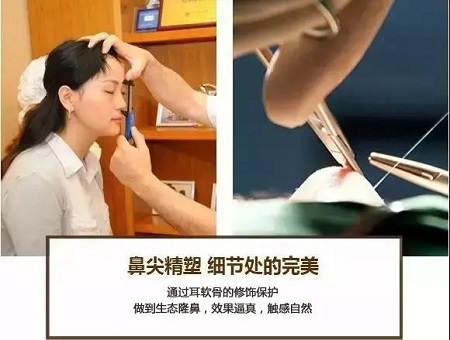 这种鼻子做了鼻整形