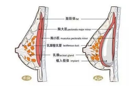 胸部乳头