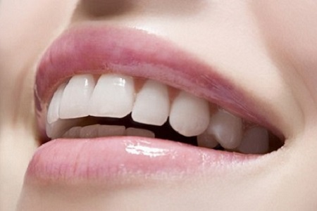 矫正牙齿会有什么副作用