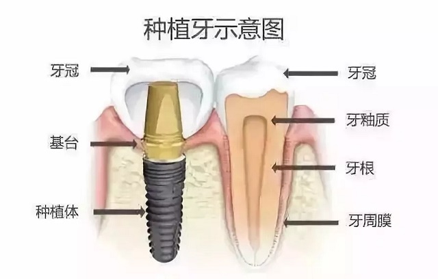 牙齿矫正