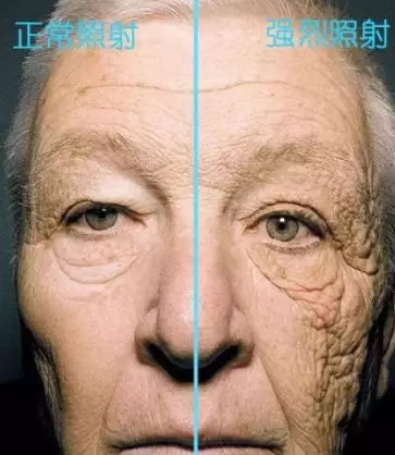 脸部胶原蛋白对比照片