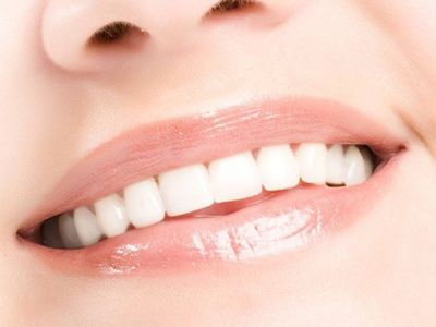 牙齿矫正一般是多少钱？