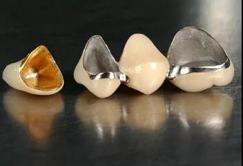 烤瓷牙PK牙贴面，谁是牙齿修复的较佳选择？！