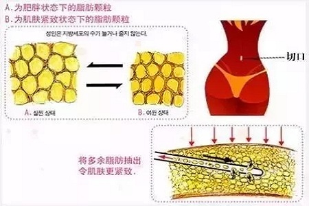 四月不吸脂，五、六、七月徒伤悲......