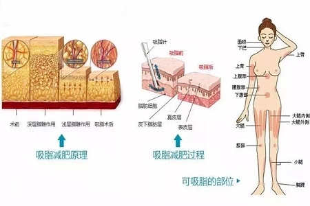 四月不吸脂，五、六、七月徒伤悲......