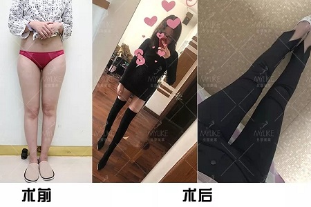 颜值：金刚如何化身长腿女神？