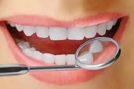 成年人是否可以矫正牙齿？
