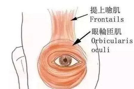 做了双眼皮，医师为什么建议要多睁眼？