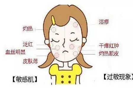 皮肤变成敏感肌怎么办？如何修复敏感肌？