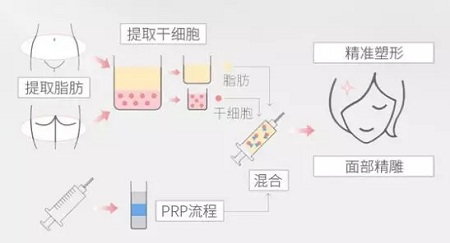 美莱实验室：瘦脸、ReFa都解决不了你的脸大问题交给我就对了