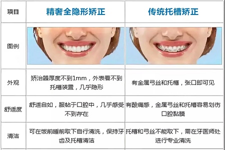 这种牙齿矫正方式，96%的人都会选择！