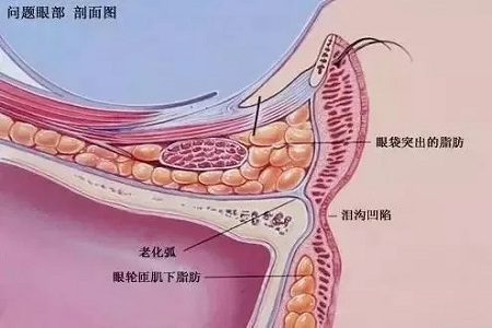 显老泪沟，你还要任其放肆吗？